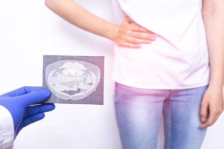 Reasons to get a routine imaging of suspected appendicitis